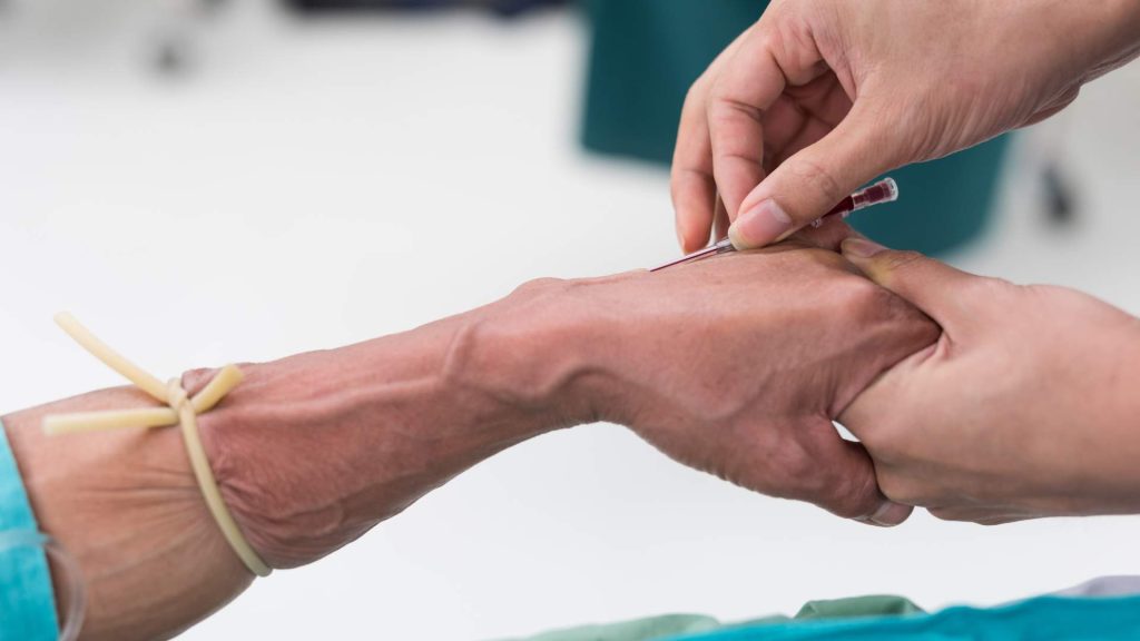 Hierro intravenoso: Beneficios y tratamiento 1 Qué es el hierro intravenoso y diferencias con otros suplementos de hierro