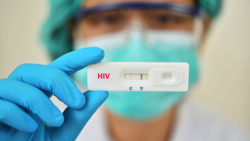 Cómo Saber si Tengo VIH: Métodos y Señales 1 Señales y Síntomas Tempranos del VIH