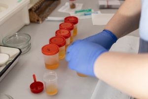 Urocultivo Descubre las Enfermedades que se Pueden Detectar en un Examen de Orina
